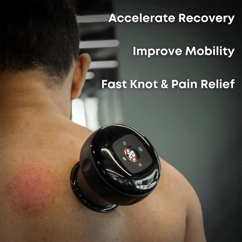 Smart Cupping Massage Device